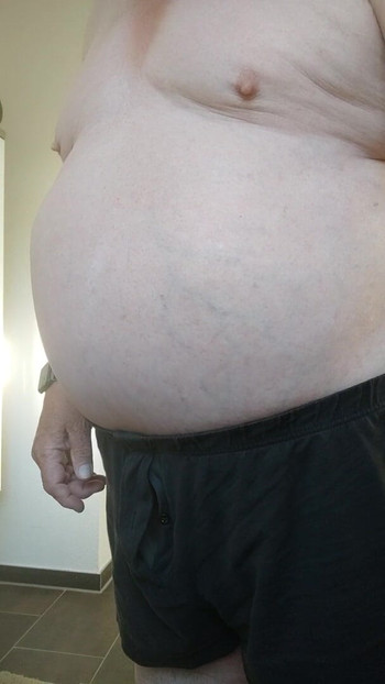 New marks on my ass