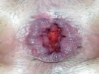 Closeup anal gaping with a bottle