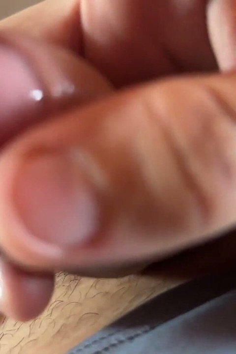 Extreme Detachment of Phimosis with Natural Oil