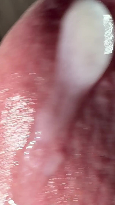 Testis Masajı