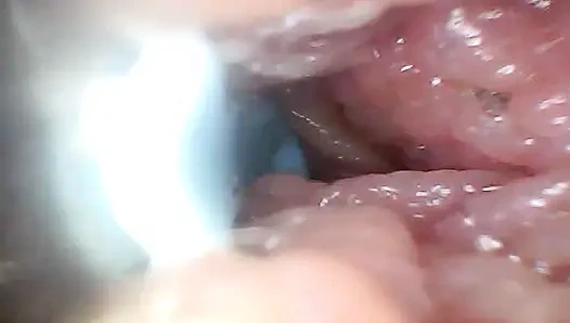 Extreme Nähe macht den Beobachter zu einem aktiven, hungrigen teilnehmer