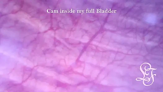 Watching my full bladder bulging out of my belly