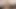 Guy With Cerebral Palsy Ejaculated His Big Dick for His Chaturbate Viewrs