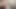 Trans Femboy Solo Masturbation Asshole Girlcock Ass Spreading Sunlight