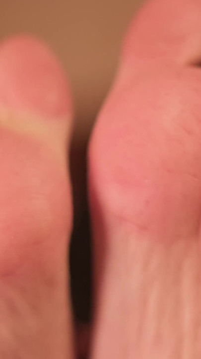 Acupuncture for My Tender Feet.