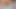 Masturbation Pat 3 / 3 Can you tell me the solution, how can I solve this problem?