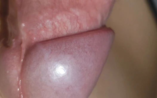 İnanılmaz dik sert venous frenulum