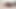 Support Us with a Camera,any Help?my Bitch Wants a White Dick Too
