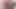 Subincision cock fqwfmasturbation