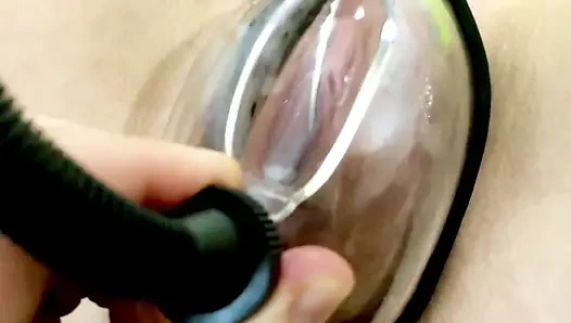 Vakum pompasının etkisi altında vajinal deformasyon