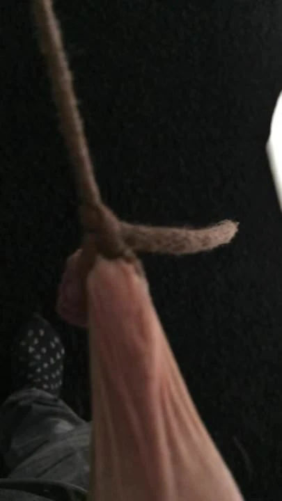 Foreskin