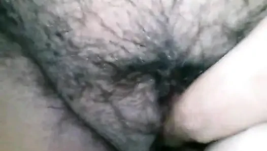 My hairy
