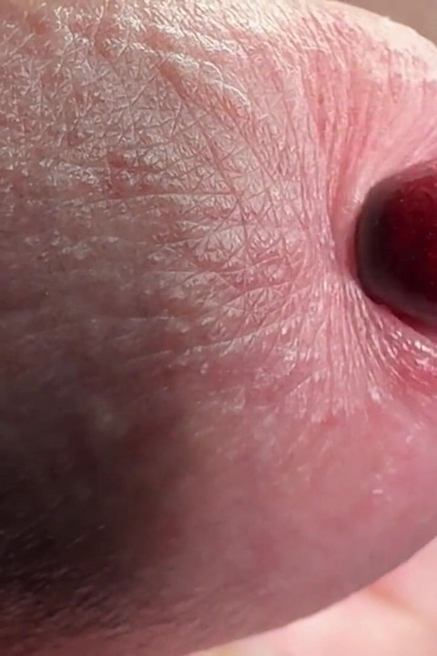 Sperm Close-up Front