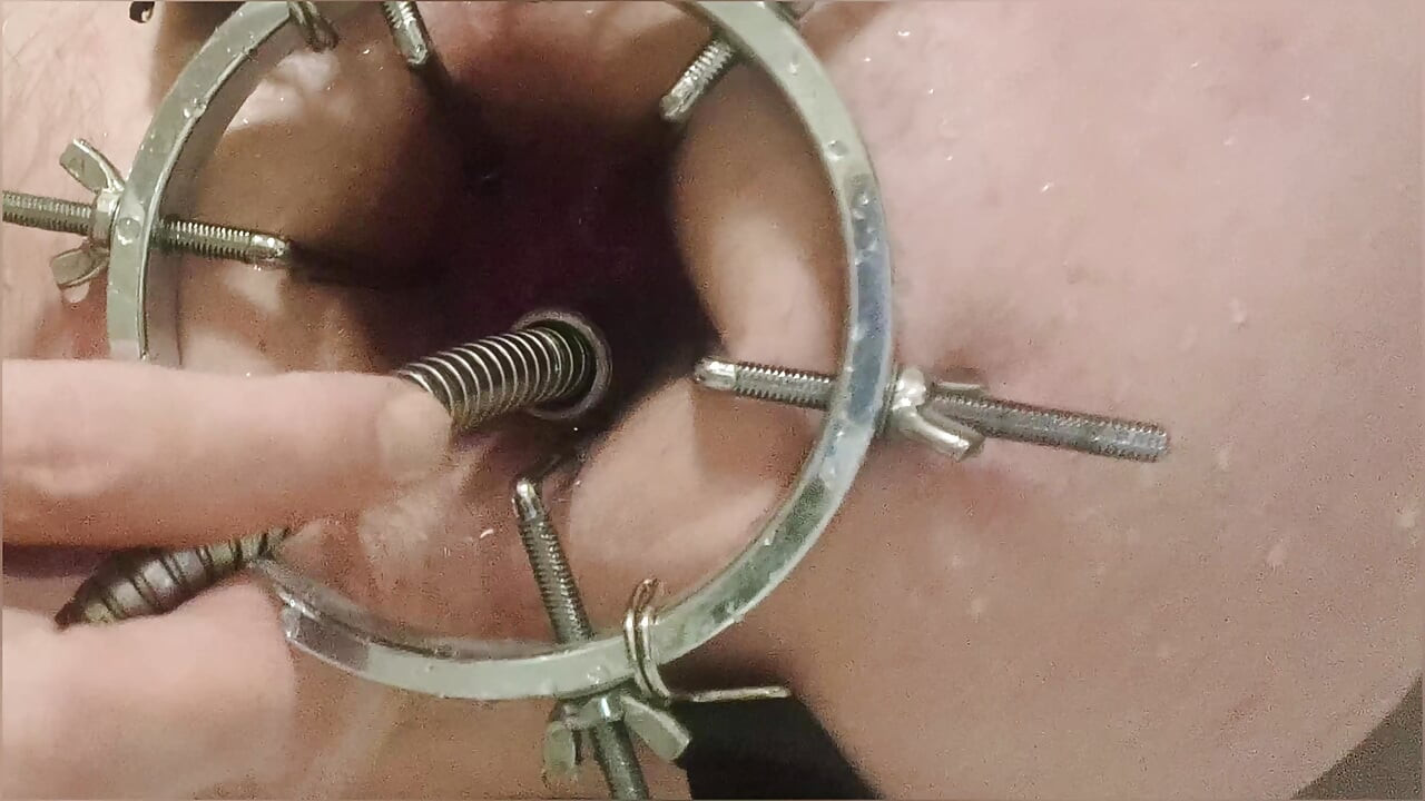 灌腸，肛門淋浴。通過肛門鏡近距離觀看。用水。將肛門裝滿水