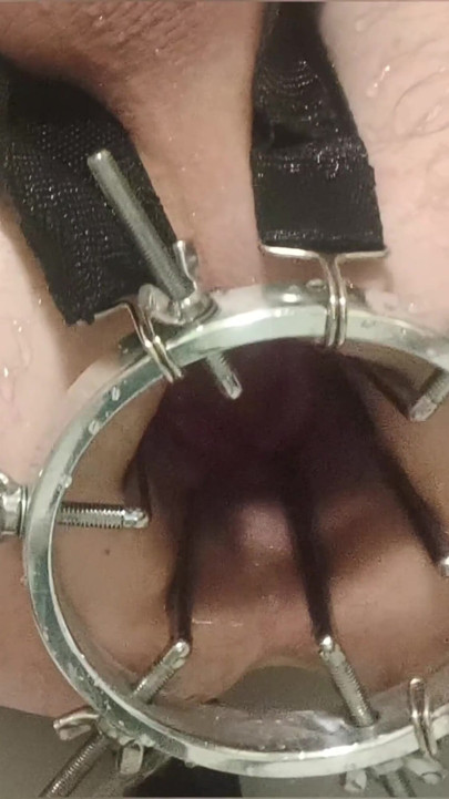 Enema, anal shower. Close-up view through anal mirror. Anal with water. Filling anal with water | Clip 2