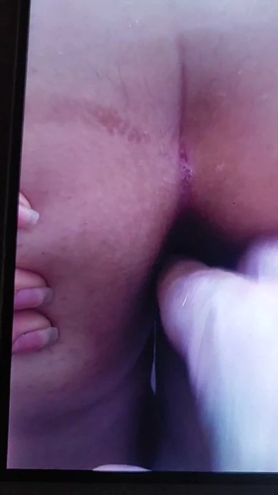 anal