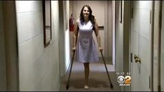 Anna - RHP Amputee on Crutches