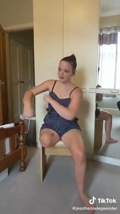 Amputee dance