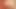 Burning Split Gland Head Into Urethra With Cigarette Tiny Cock and Balls
