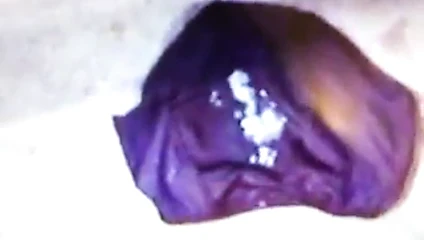 Büyük külot boşalma