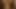 the dream: hairy armpits 102