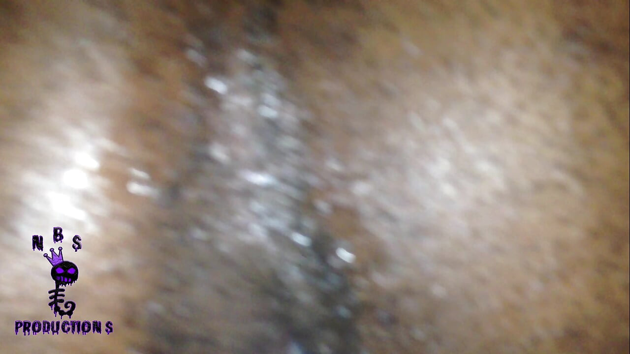 흑인 육종가 114