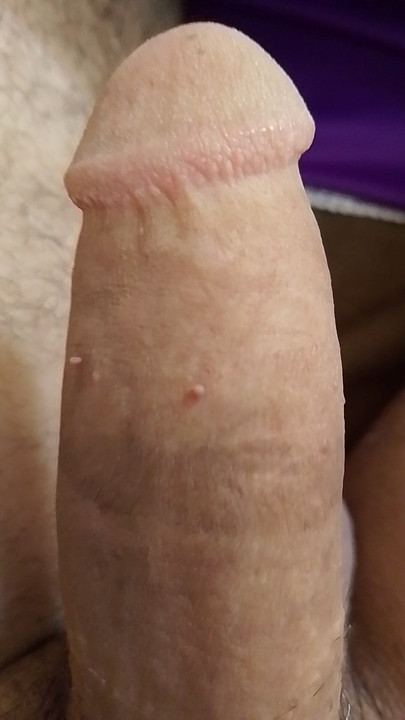 Cock showing
