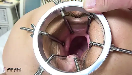 Mehr Fisting-erkundung