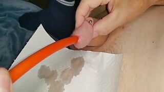 xH_Handy_Mein intestinal tube in the dick from 19.06.22