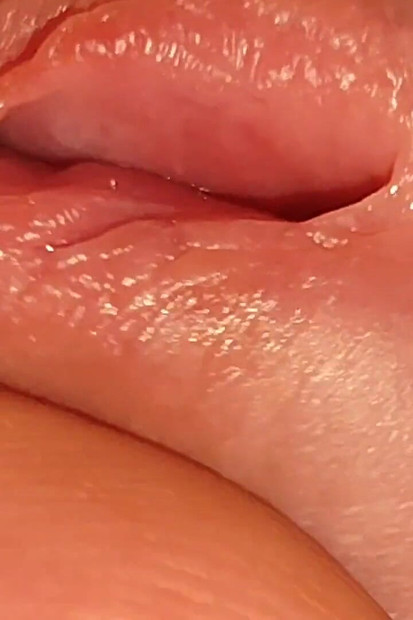 How to Widen a Glans Hole to the Extreme.