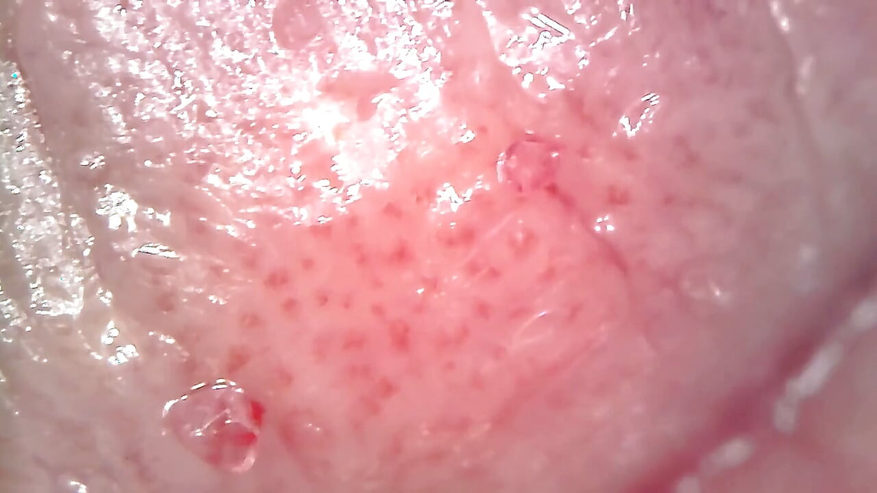 Medical Endoscope Oral Exam: Gummy Chewing, Extreme Teeth & Tongue Macro