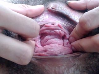 File cabul: 18 tahun keluar daging vagina berbulu