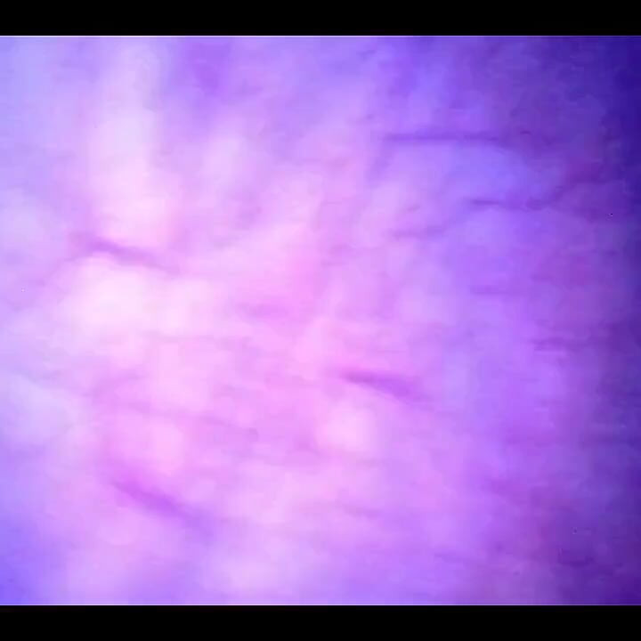 Beautiful Inside POV of My Full Bladder with the Endoscope!