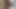 Anal Sex Video