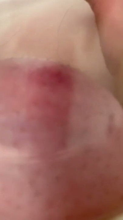 Nipple sucker | Clip 1