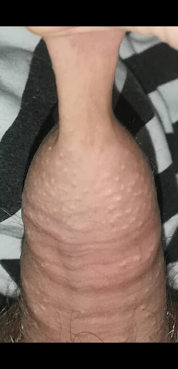 Meminggirkan zakar kecil saya