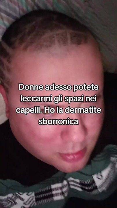 The tik tok master suffers from dermatitis