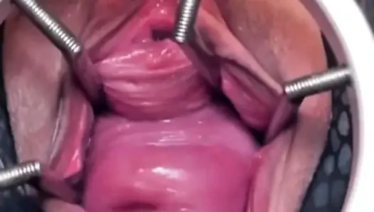 Showing Off My Pumped Cervix
