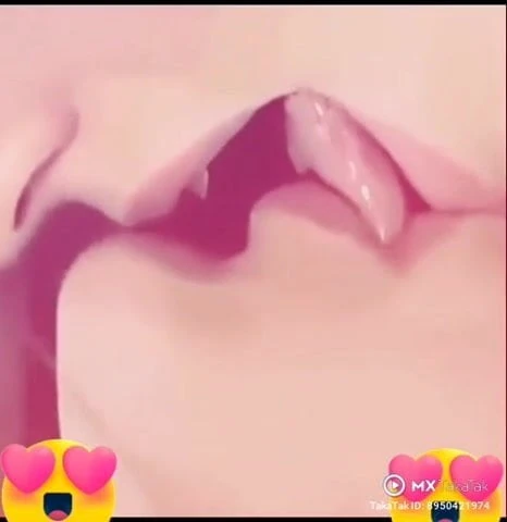 Kiss