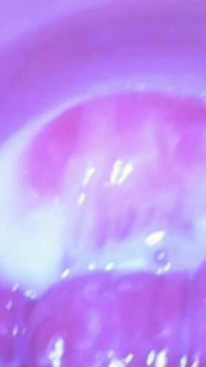 Lewd Wife: Observation, Close-Up Shots, Clitoral Magnification, Full View Inside the | Clip 3