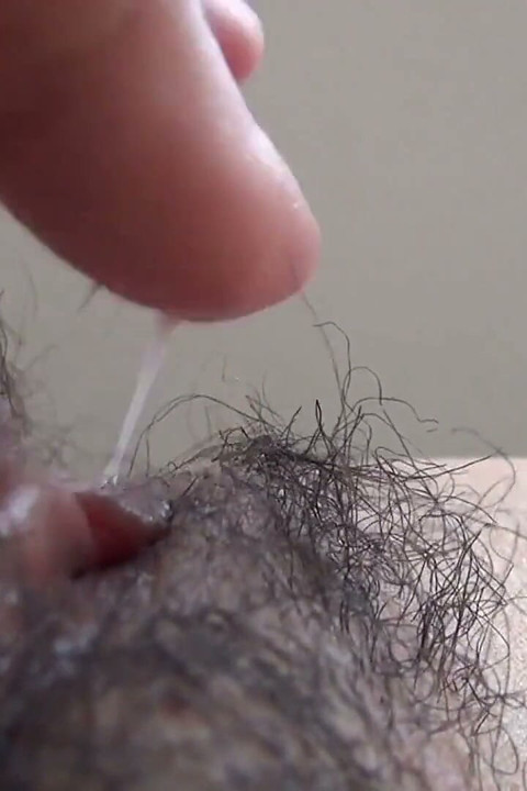 The Mound of the Clitoris