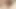Evening Masturbation of a White Uncircumcised Penis.