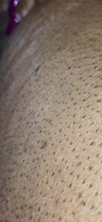 Epikus pillanat az "A Lil Tease" -ből