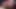 Teaser #2