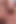 Genç kız boğazında büyük yarakla ateşli görünüyor