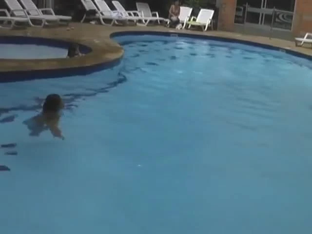 Rachel DAK Amputee