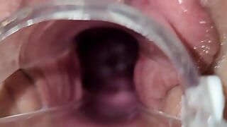 Espéculo colo do útero - orgasmo ejaculação