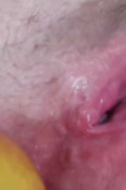 Ακραίος χυμός