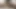 Trans Prostate orgasm double cum cumshoot compilation