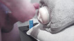 Pregled videozapisa